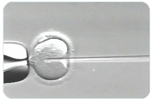intracytoplasmic sperm injection with needle piercing a female egg | Tennessee Reproductive Medicine | Chattanooga, TN